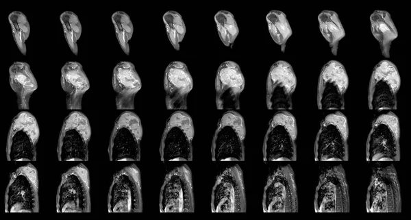 Resonancia Magnética Del Tumor Hombro Ciencia Masas Educación Resonancia Magnética — Foto de Stock