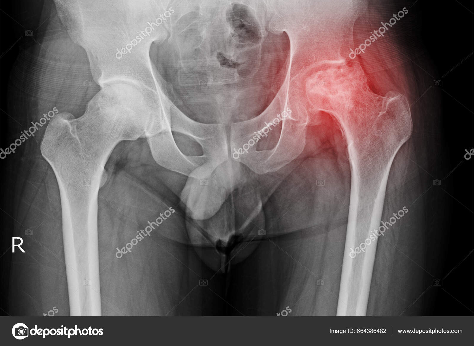 Estudando Radiologia (@radiologia_studygram) • Instagram photos and videos, image size:1600x1167