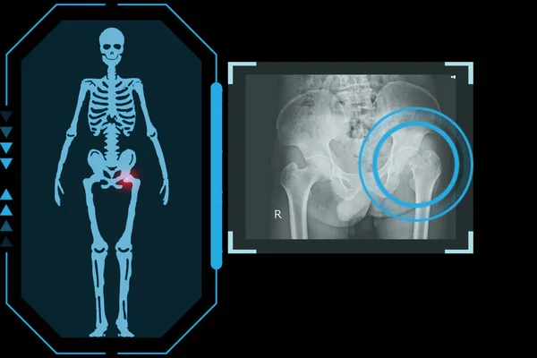 Изучает Технологическую Цифровую Голографическую Пластину Представляющую Тело Пациента Остеоартрит Бедра — стоковое фото