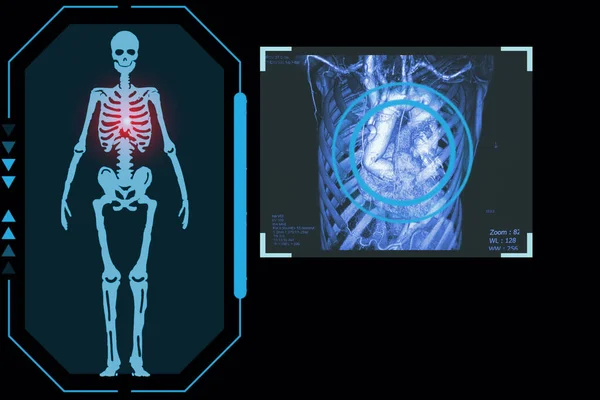 Examines Technological Digital Holographic Plate Representing Patient Body Chest Cardio — Stock Photo, Image