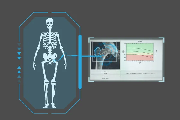 Examines Technological Digital Holographic Plate Representing Patient Body Results Densitometry — Stock Photo, Image
