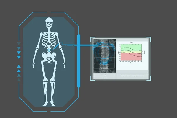 Изучает Технологическую Цифровую Голографическую Табличку Представляющую Тело Пациента Результаты Денситометрии — стоковое фото