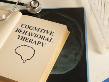 CBT Cognitive behavioral therapy is shown as medical and psychological concept