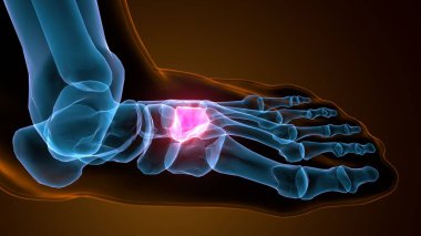 Orta ayak kemiğinin 3 boyutlu görüntüsü - ön görünüm