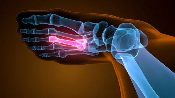 Metatarsal Foot Bones Anatomy for medical. 3D Illustration