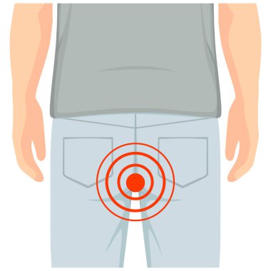 illness hemorrhoids, boils pimples swelling. flat design. person feel painful. Rectum inflammation causing bleeding and pain