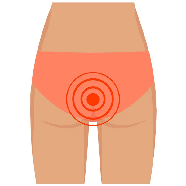 Illness Hemorrhoids Boils Pimples Swelling Flat Design Person Feel Painful — Wektor stockowy