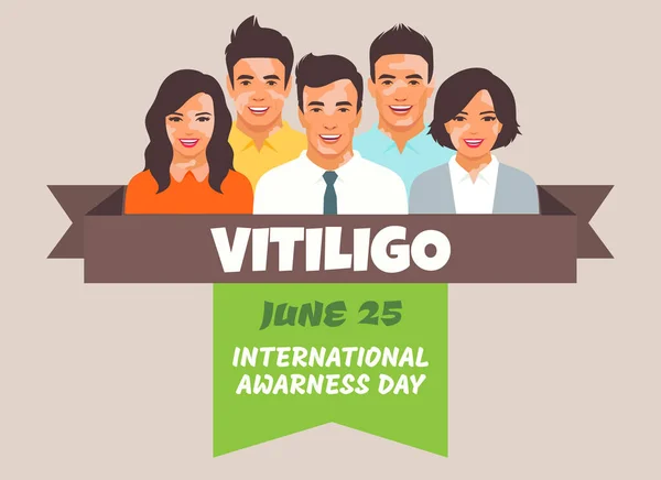 Vitiligo Menschen Isoliert Flache Vektoraktiendarstellung Das Konzept Der Unterschiedlichen Schönheit — Stockvektor