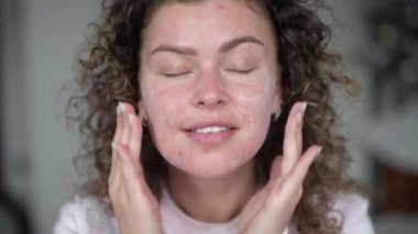 Akne tenli genç ve güzel bir kadın, evde güzellik tedavisi yapıyor.