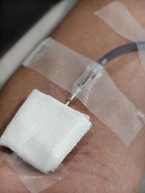 Kan bağışı yaptıktan sonra insan koluna tıbbi pamuklu ped ve iğne deliği bölgesini kaplayan temiz bir bant. Görüntü iyileşmeyi, sağlık hizmetini, gönüllülüğü ve hayat kurtarmak için kan bağışlamayı temsil ediyor..