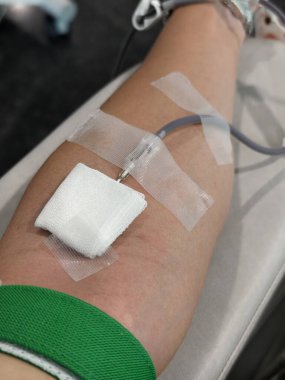 Kan bağışı yapan birinin yakın plan görüntüsü. İğne koluna sokuluyor, tıbbi bantla korunuyor ve kan toplama tüpüne bağlanıyor. Yeşil turnike uygulanır. Görüntü sağlık, yardım, tıbbi prosedürleri temsil ediyor.