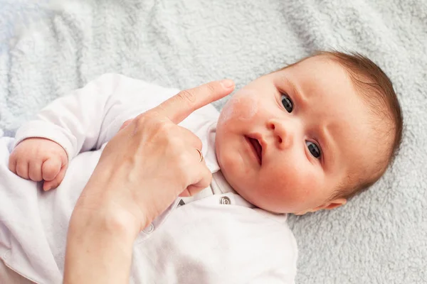 Bebê Com Dermatite Atópica Recebendo Creme Posto Cuidados Prevenção Eczema Imagem De Stock