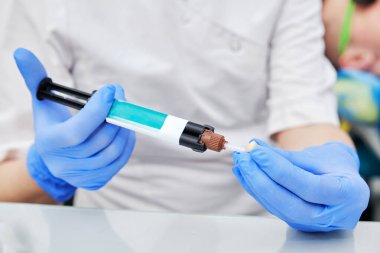 Mavi Eldivenli Dişçi Diş Tacı İçin Çimento Hazırlıyor. Diş kaplamalarını güvence altına almak için kullanılan araçları ve yapışkan maddeleri vurgulayan ayrıntılı görünüm. Diş kaplaması yerleştirme prosedürünün ilk adımlarını gösteren resim.