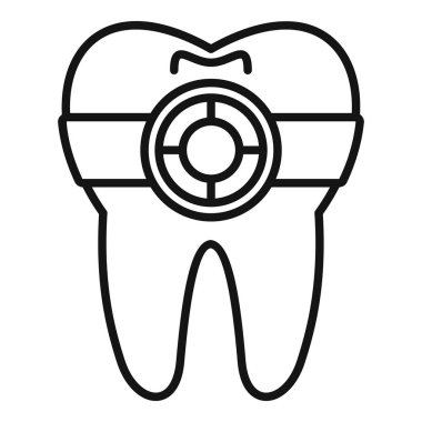Diş barajı uygulanmış basit bir diş çizimi. Diş prosedürleri sırasında hijyene önem veriliyor.