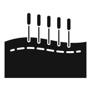 Akupunktur iğneleri hastanın vücuduna meridyen boyunca yerleştiriliyor. Ağrıyı tedavi etmek ve sağlığını geri kazanmak için.