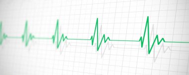 Kalp atışlarının sağlıklı olduğunu gösteren tıbbi bir örnek.