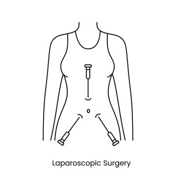 Vektör içinde Laparoskopik ameliyat simgesi çizgisi, tıbbi bir prosedürün çizimi