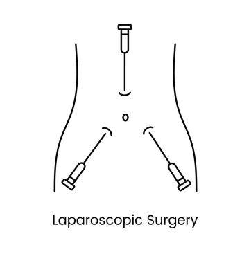 Laparoscopic surgery icon line in vector, medical illustration