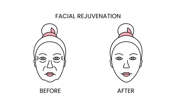 Oživení Obličeje Laserová Kosmetika Před Zákrokem Aplikaci Ikony Linie Léčby — Stockový vektor