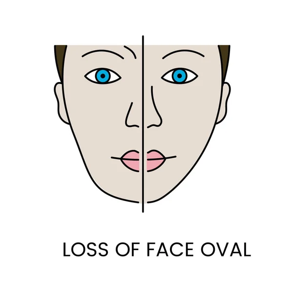 Ztráta Kontur Obličeje Vektoru Ilustrace Změn Tvaru Obličeje Souvisejících Stárnutím — Stockový vektor