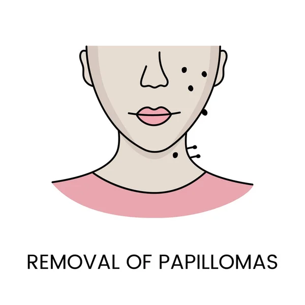 stock vector Removal of papillomas with the help of laser cosmetology, in vector woman face with papillomas.