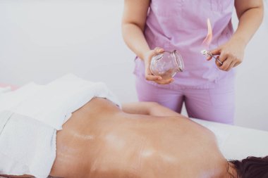Hijama terapisi hastanın derisine ısıtılmış vakum bardakları ile ağrı sorunlarını iyileştirmek için..