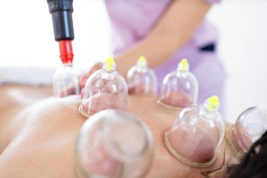 Kronik ağrı ve rahatlama için eski bir alternatif ilaç. Hijama terapisi profesyonel terapist tarafından gerçekleştiriliyor. Vakum bardaklarına odaklan..
