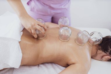 Hasta sırtına hijama tedavisi uygulayan profesyonel bir kadın terapist. Kronik ağrıyı dindirmek için ısıtılmış vakum bardakları yerleştiriyorum..