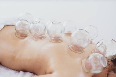 Hijama alternatif tıp terapisi kronik ağrı kesici ve rahatlama için. Cam süpürge bardaklarına odaklan..