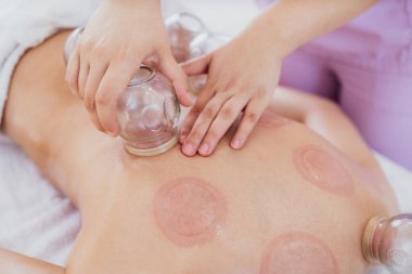 Hijama alternatif tıp terapisi kronik ağrı kesici ve rahatlama için. Vakumlu bardaklara odaklan.