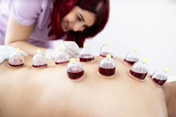 Terapeuta Profesional Realizando Tratamiento Hijama Espalda Del Paciente Concéntrate Vasos — Foto de Stock