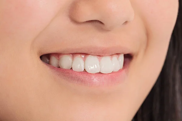 Close Perfect White Teeth Asian Woman — Foto de Stock