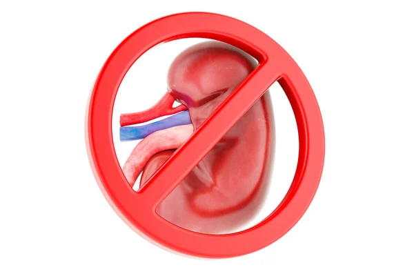 Menselijke Nier Met Verboden Symbool Rendering Geïsoleerd Witte Achtergrond — Stockfoto