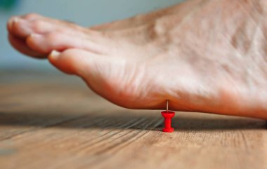 Bir insanın ayağına iğne batırmak -- sinir ağrısı konsepti