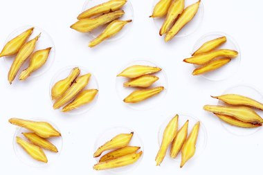 Petri kabında parmak kökü