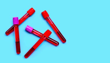 Mavi arka planda test tüplerindeki kan. Üst görünüm