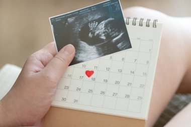 Hamile kadınlar doğum öncesi kurslara katılarak, hastane çantalarını toplayarak ve ulaşımı sağlayarak doğum için hazırlanmalıdır. Bir doğum planına sahip olmak ve gerekli tüm belgeleri temin etmek gereklidir.