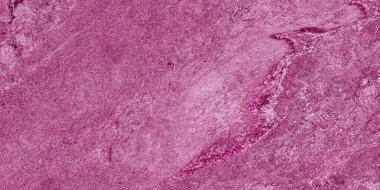Doğal koyu pembe mermer desen, karışık teknikler soyut tablolar, pembe mermer desen.