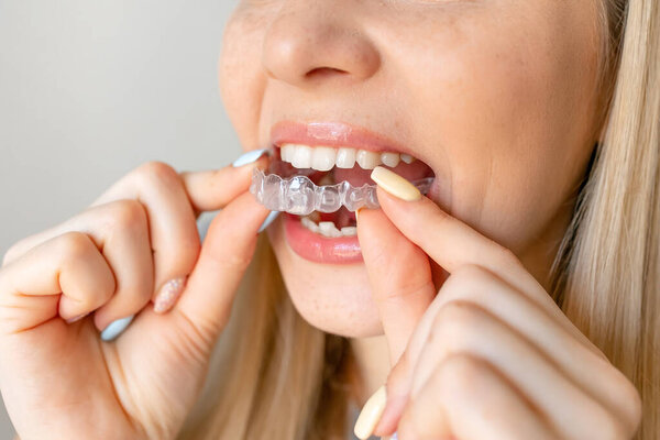 Closeup of woman's mouth putting on a transparent retainer with soft natural lighting