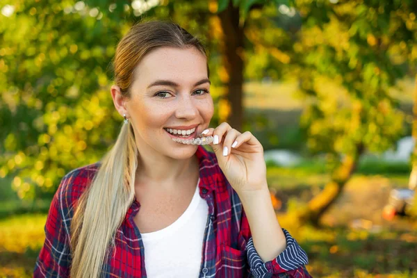 Jovem Feliz Com Dentes Invisíveis Aligner — Fotografia de Stock