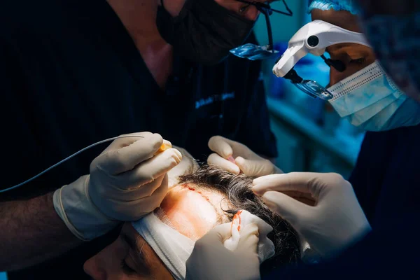 Een Team Artsen Voert Een Haartransplantatie Uit Een Man Haaruitval — Stockfoto