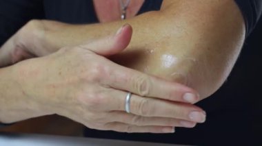 Kadının yaralı dirseğine merhem sürerken çekilmiş görüntüleri..