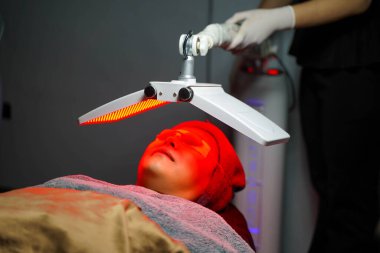 PDT fotoğraf dinamik tedavisi, akne tedavisine yardımcı olur, iltihabı azaltır, kolajen üretimini canlandırır. Kırışıklıkları azaltır