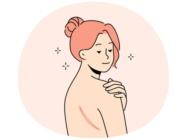 Голая женщина со шрамом на спине. Женщина демонстрирует отметину или рану на теле. Несовершенство кожи. Векторная иллюстрация.