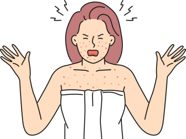 Vücudunda alerji olan kızgın bir kadın.