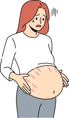 Karnında gerilme izleri olan hamile bir kadın.