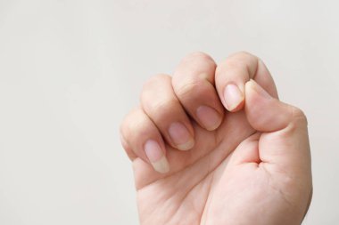 Uzun, kirli tırnaklar ve bakteriyel mikroplarla ilgili sorunlar.