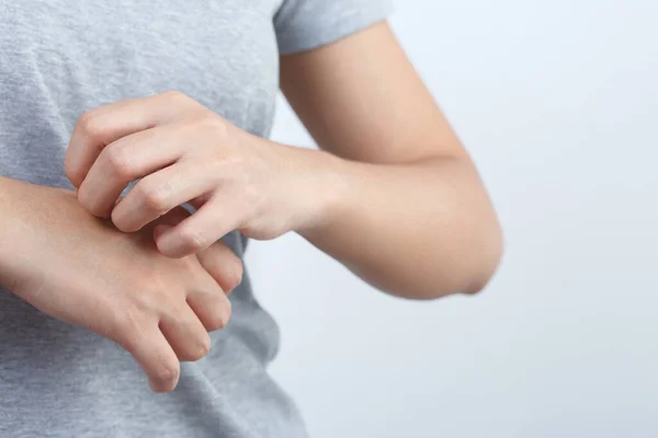 stock image Health problems, woman has itchy hands