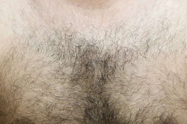 A man with black chest hair