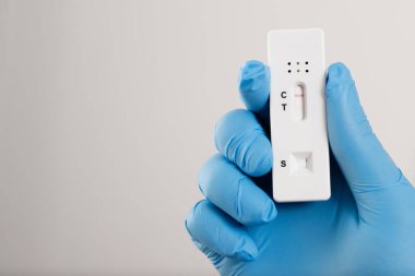 Hastanedeki laboratuvardan Covid-19 test kiti getiren doktor.